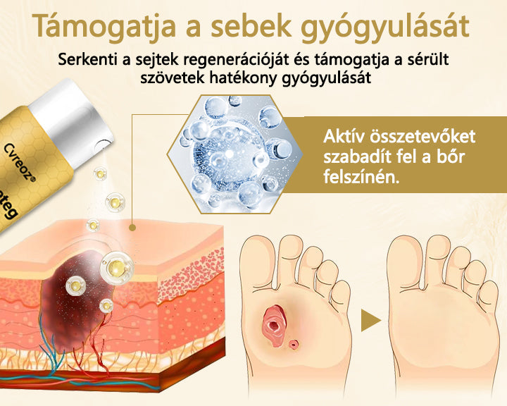 🔥Cvreoz® méhméreg gyógyító spray a sebek gyógyulására és regenerálására a kezeken és a lábakon🎉