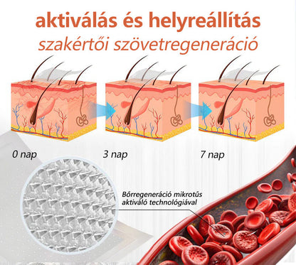 🌈 Zvoevo® Vein Ease mikro-tűs ápoló tapasz (pókgerincvénák, visszér, duzzanat, fáradt lábak kezelésére)