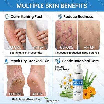 🔥Healrize® Magnesium Botanic Spray – Advanced Skin Recovery for Psoriasis & Eczema | Rapid Soothing, Steroid-Free