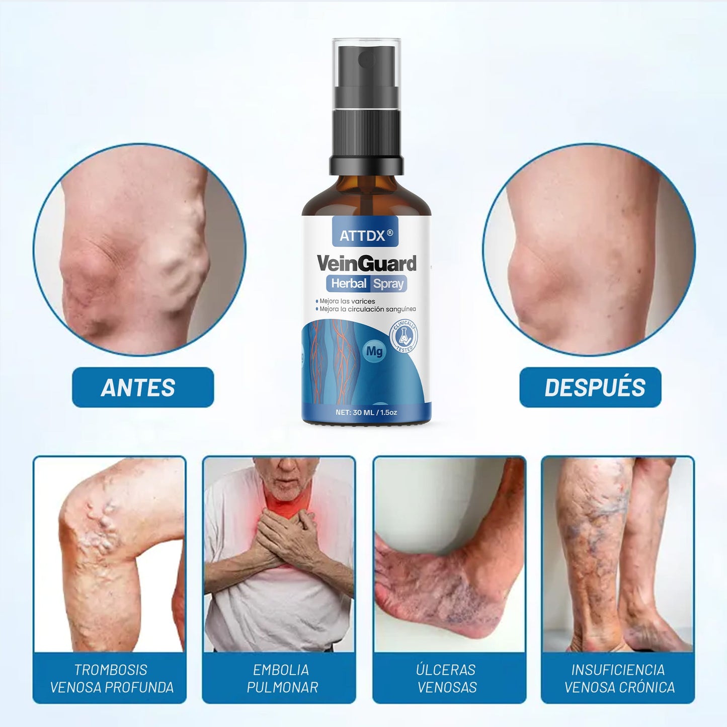 VEINGUARD Herbal Spray 2x1! | Desinflama y Mejora la Circulación.