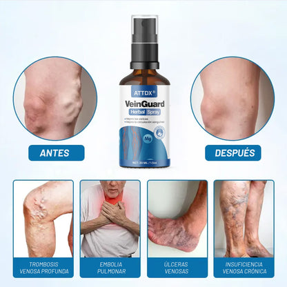 VEINGUARD Herbal Spray 2x1! | Desinflama y Mejora la Circulación.
