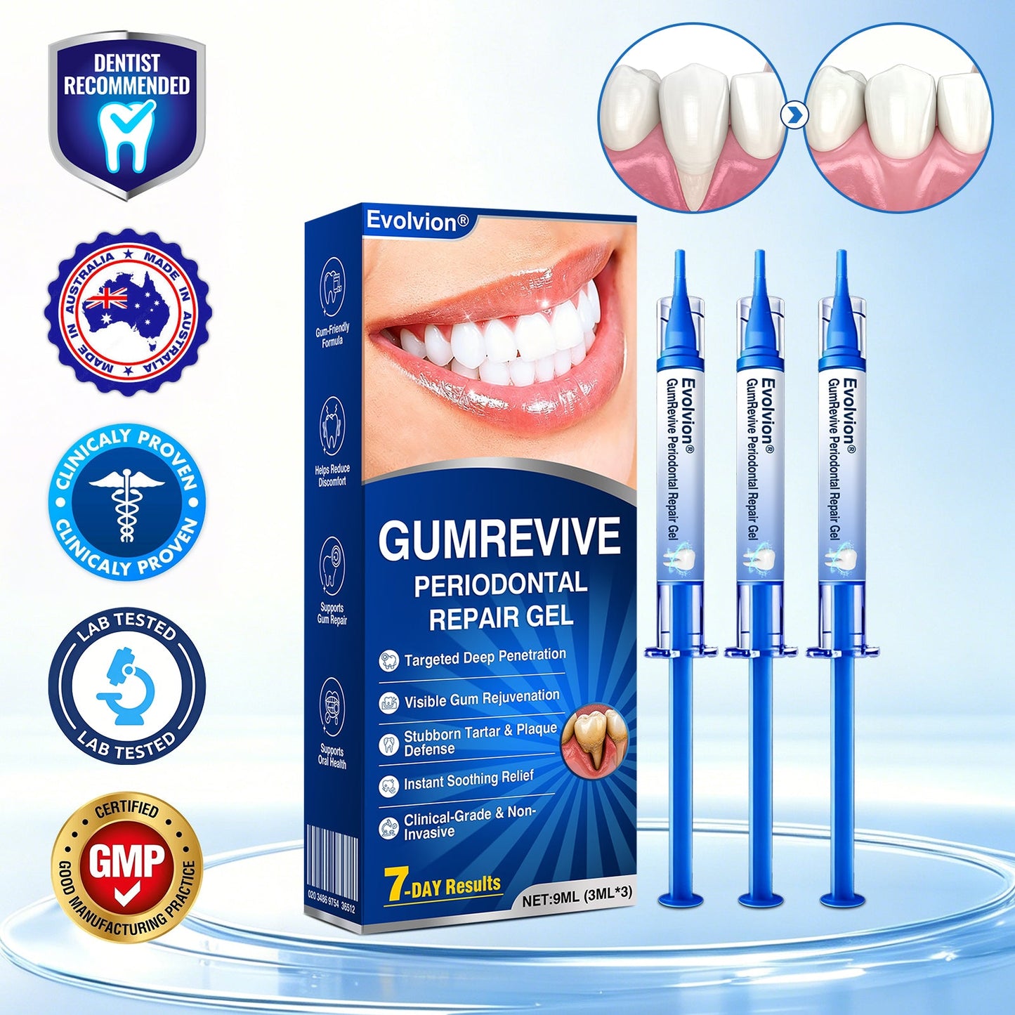 👨‍⚕️🦷✨Evolvion® GumRevive fogágyregeneráló gél