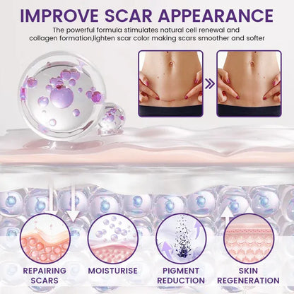TiMilk - ReGen Scar Stem Cell Repair Gel (Imported)
